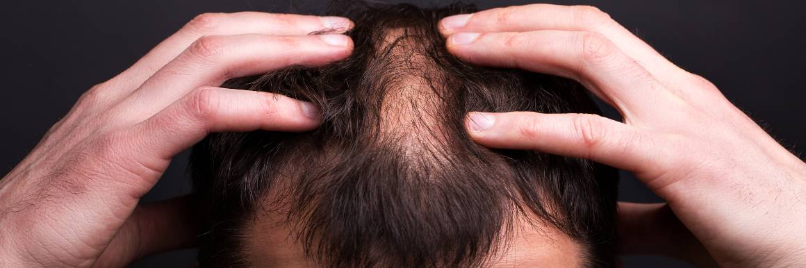 Why Nicotinamide Mononucleotide (NMN) might affect hair growth